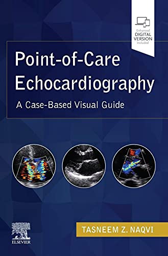 اکوکاردیوگرافی نقطه مراقبت- راهنمای تصویری مبتنی بر مورد بالینی - قلب و عروق